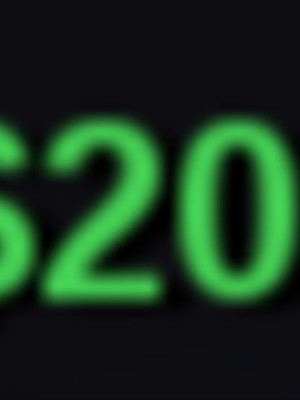 $20.000.000